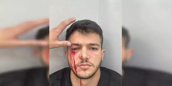 MÉDICO É AGREDIDO POR ACOMPANHANTE DE PACIENTE QUE MORREU EM UPA DURANTE ATENDIMENTO