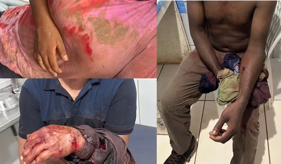 ‘GUERRA DO DENDÊ’: PISTOLEIROS DEIXAM TRÊS PESSOAS FERIDAS EM 2ª INVASÃO A ALDEIA DO PA EM MENOS DE UMA SEMANA