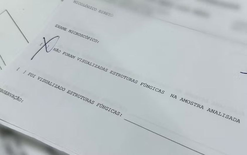 LABORATÓRIO SUSPEITO DE FRAUDES FUNCIONAVA HÁ 7 ANOS E REALIZAVA MAIS DE 8 MIL TIPOS DE EXAMES A BAIXO CUSTO, DIZ DELEGADA