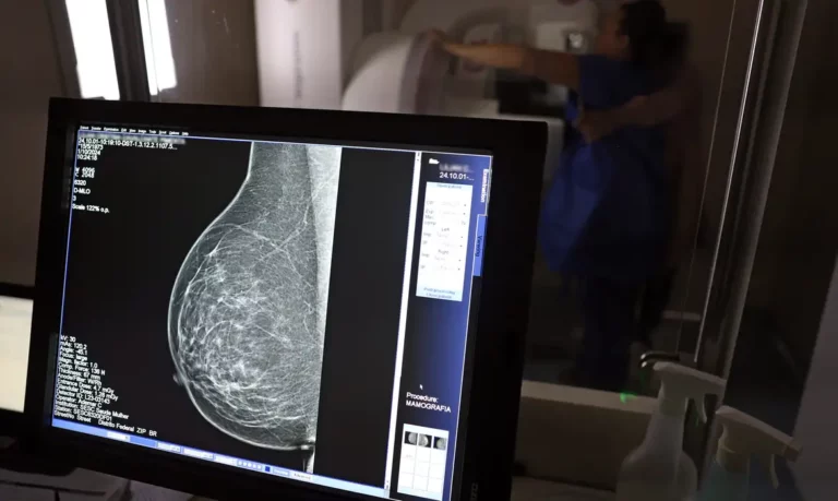 ALTA FLORESTA: HOSPITAL DE AMOR CHAMA MULHERES PARA CONSULTAS NO OUTUBRO ROSA