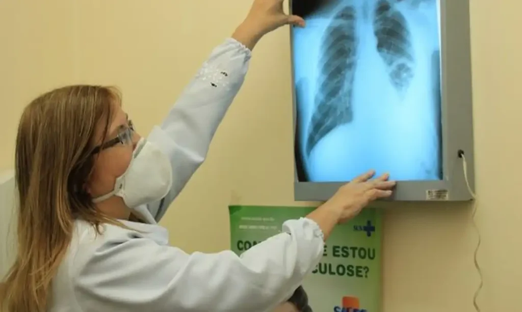 MINISTÉRIO DA SAÚDE REPASSA R$ 100 MILHÕES PARA COMBATE À TUBERCULOSE EM 913 MUNICÍPIOS